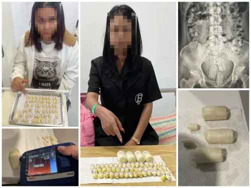 泰国女子体内藏72粒海洛因胶囊 在高雄机场落网
